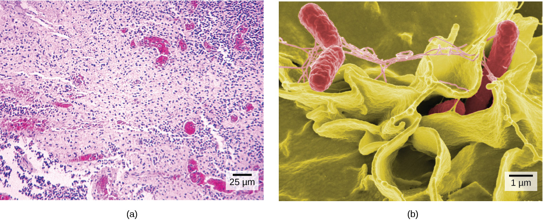 Salmonella văzută la microscop